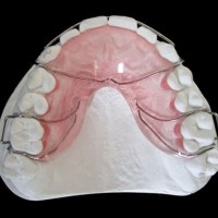 牙套生产商、牙套供应商、牙套制造商、牙套源头厂家、牙套生产厂